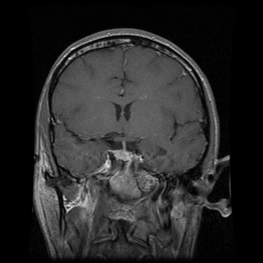  |  